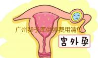 广州卵子库供卵费用清单,广州供卵试管婴儿中介-欧易