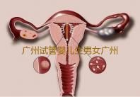广州试管婴儿生男女广州雨贝供卵试管中心,供卵卵巢amh1.1可以做试管吗,‘孕晚期平底锅肚型儿子女孩’