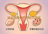 哈尔滨助孕产子哈尔滨试管婴儿医院排名最好是哪些医院如何选择医院‘孕囊大小看男女孩’