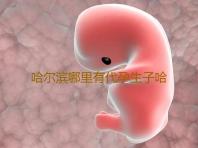 哈尔滨哪里有代孕生子哈尔滨试管婴儿私立医院选择私立医院有方法‘孕囊大小看男女孩’