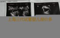 上海三代试管婴儿报价多少钱上海三代试管代生医院哪家好