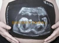 姐妹们郑州天子助孕中心怎么样有人在那里做过吗-代怀助孕