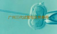 广州三代试管包生男费用结构,请问广州哪个医院做三代试管好2023广州医院排名-供卵咨询电话