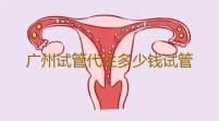 广州试管代生多少钱试管代孕公司
